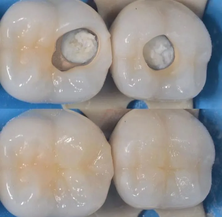 Alanya HEALTHY TEETH Dental Aesthetic — Медицина в Аланье: Онлайн-заказ, цены и отзывы