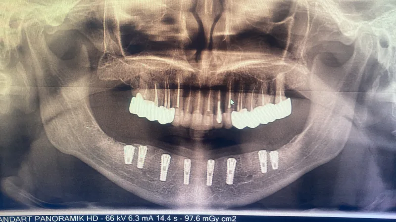 Alanya HEALTHY TEETH Dental Aesthetic — Медицина в Аланье: Онлайн-заказ, цены и отзывы